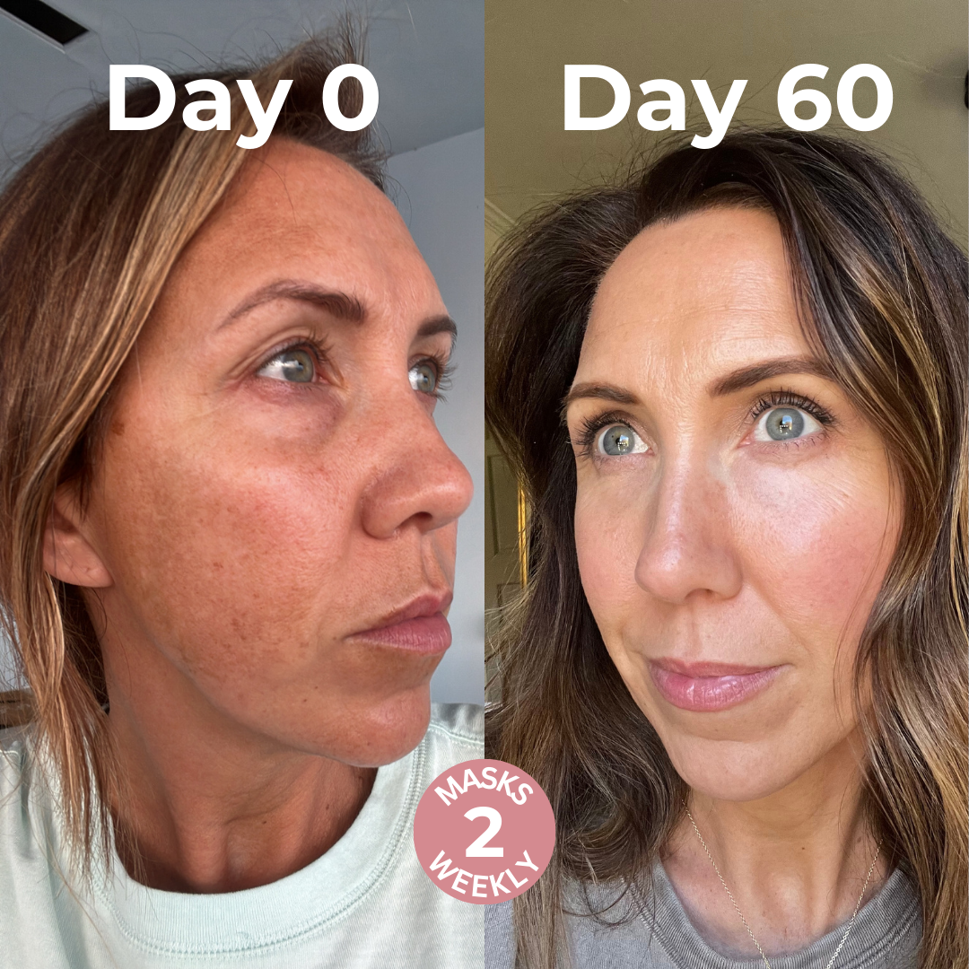 Glow Up Mask - Early Black Friday Sale
