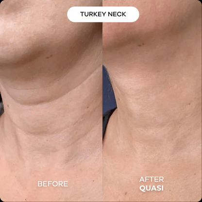 Collagen Neck Mask