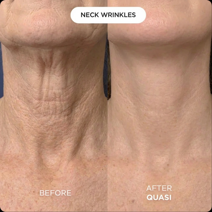 Collagen Neck Mask (free gift)
