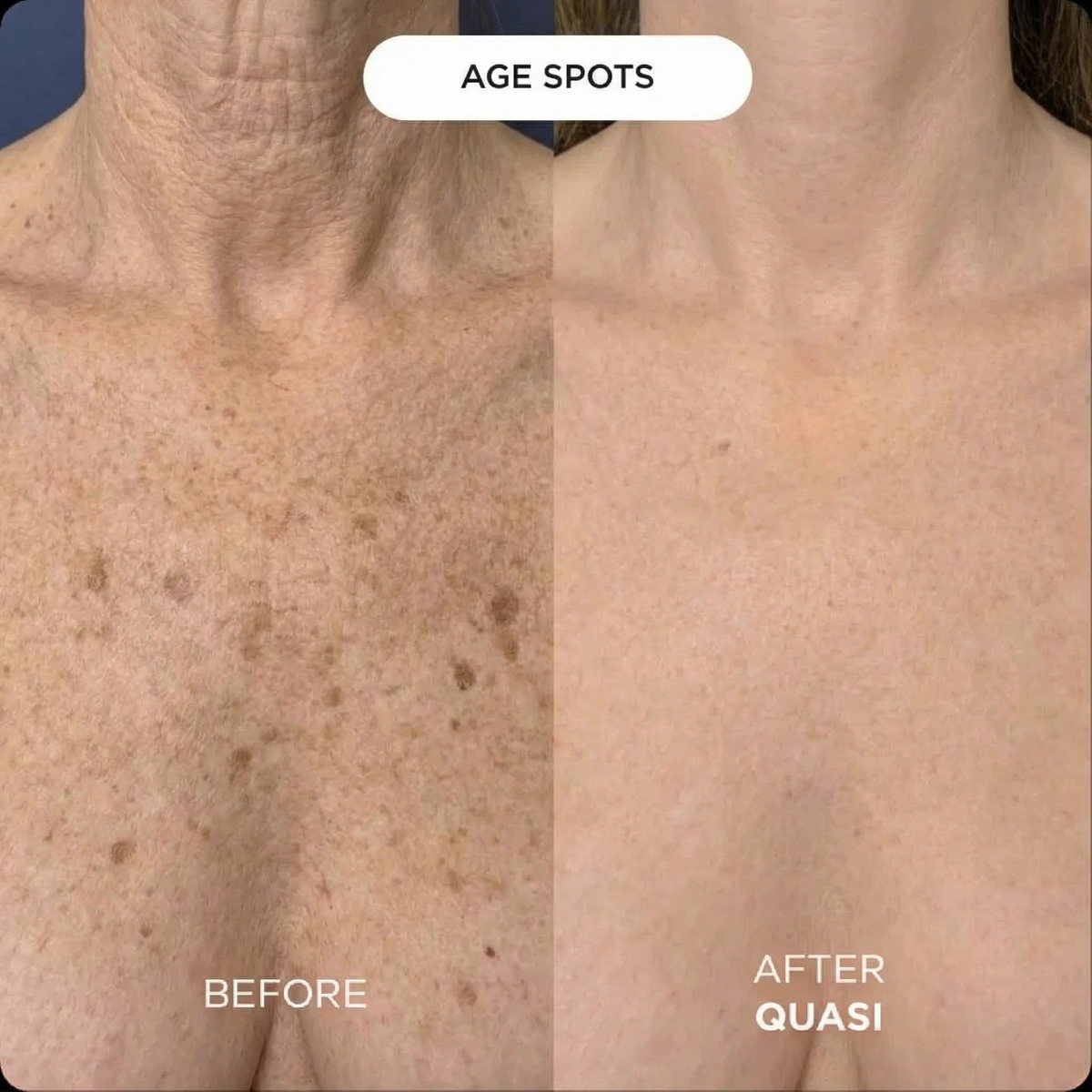 Collagen Chest Mask (free gift)