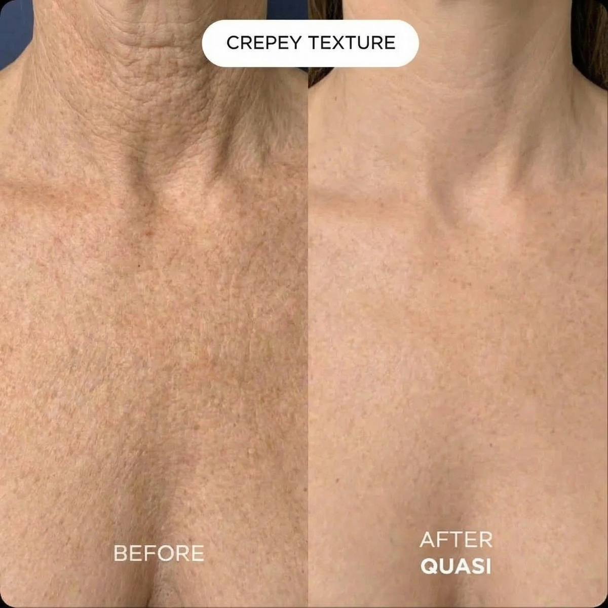 Collagen Chest Mask (free gift)